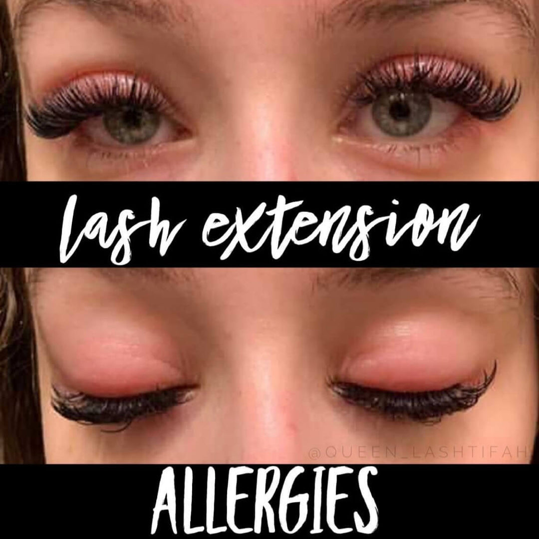 How to Handle Allergic Reactions During a Lash Appointment