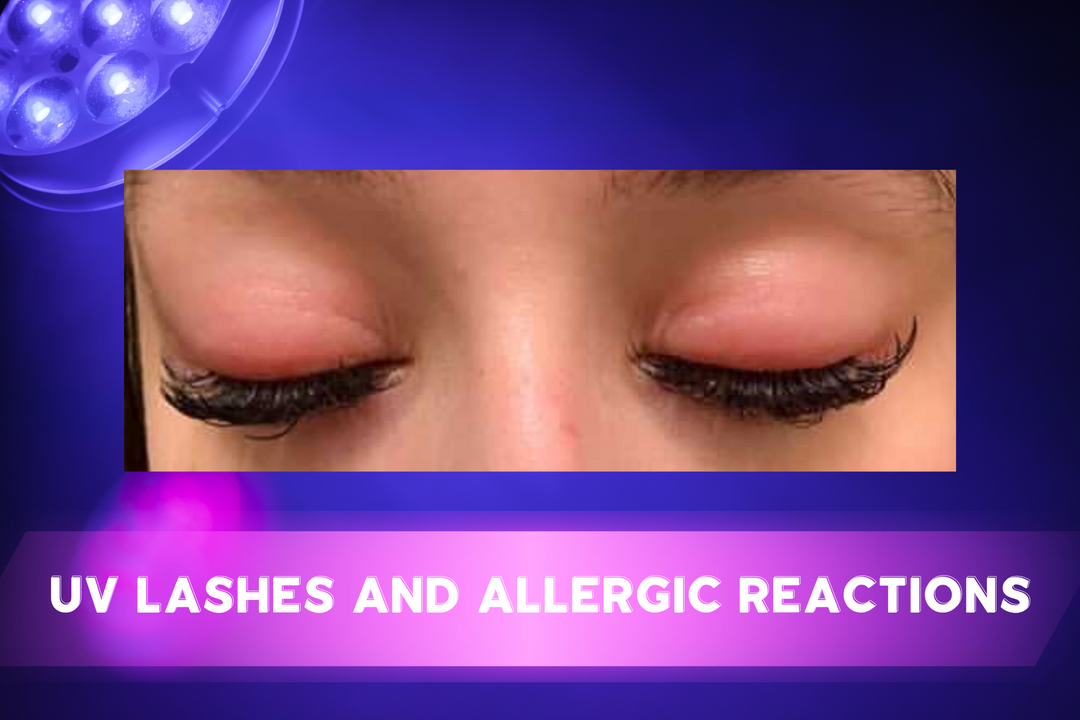 Understanding UV Adhesives: Allergic Reactions vs. Irritations in Lash Extensions